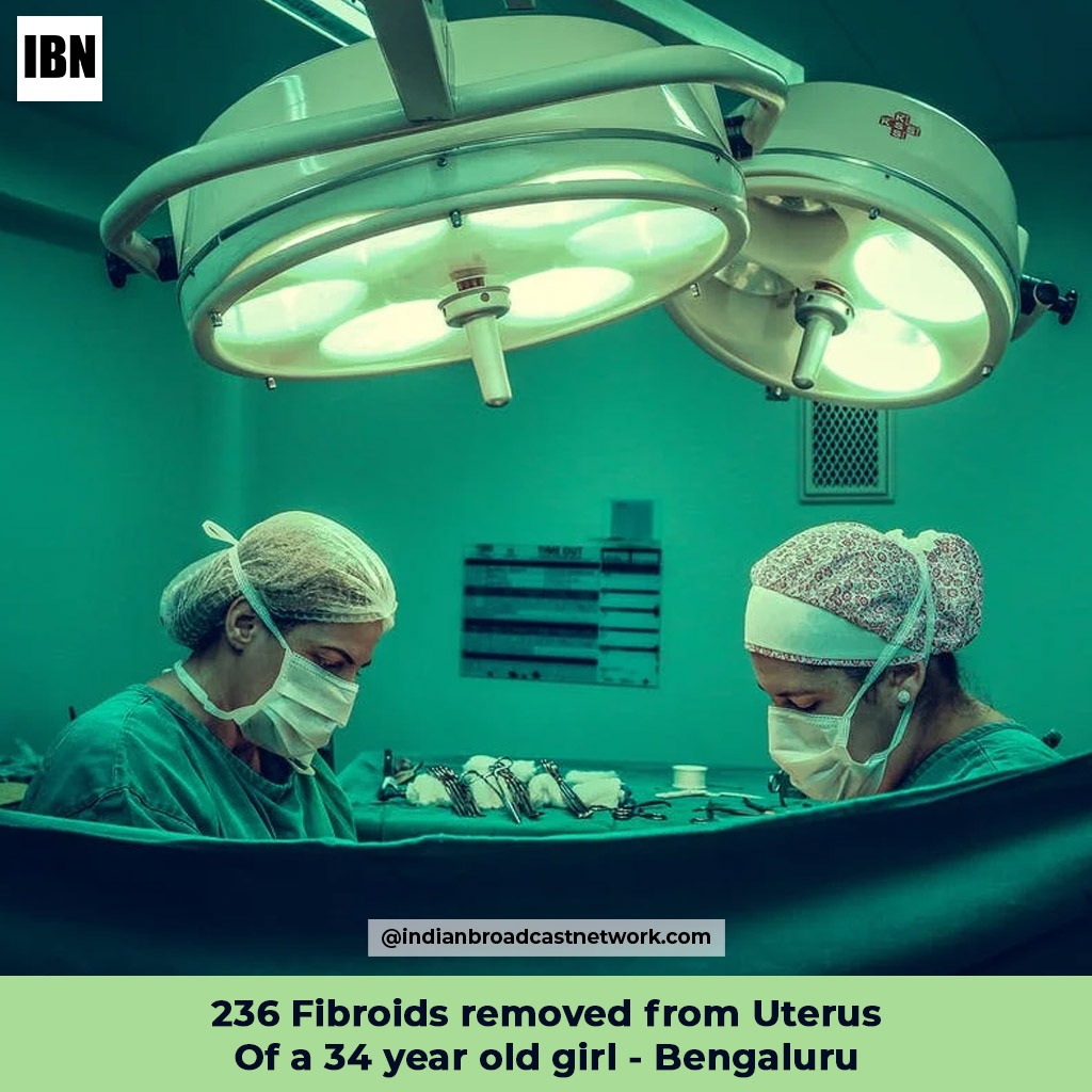 236 Fibroids removed from the uterus of a 34 year old girl-Bengaluru - Indian Broadcast Network
