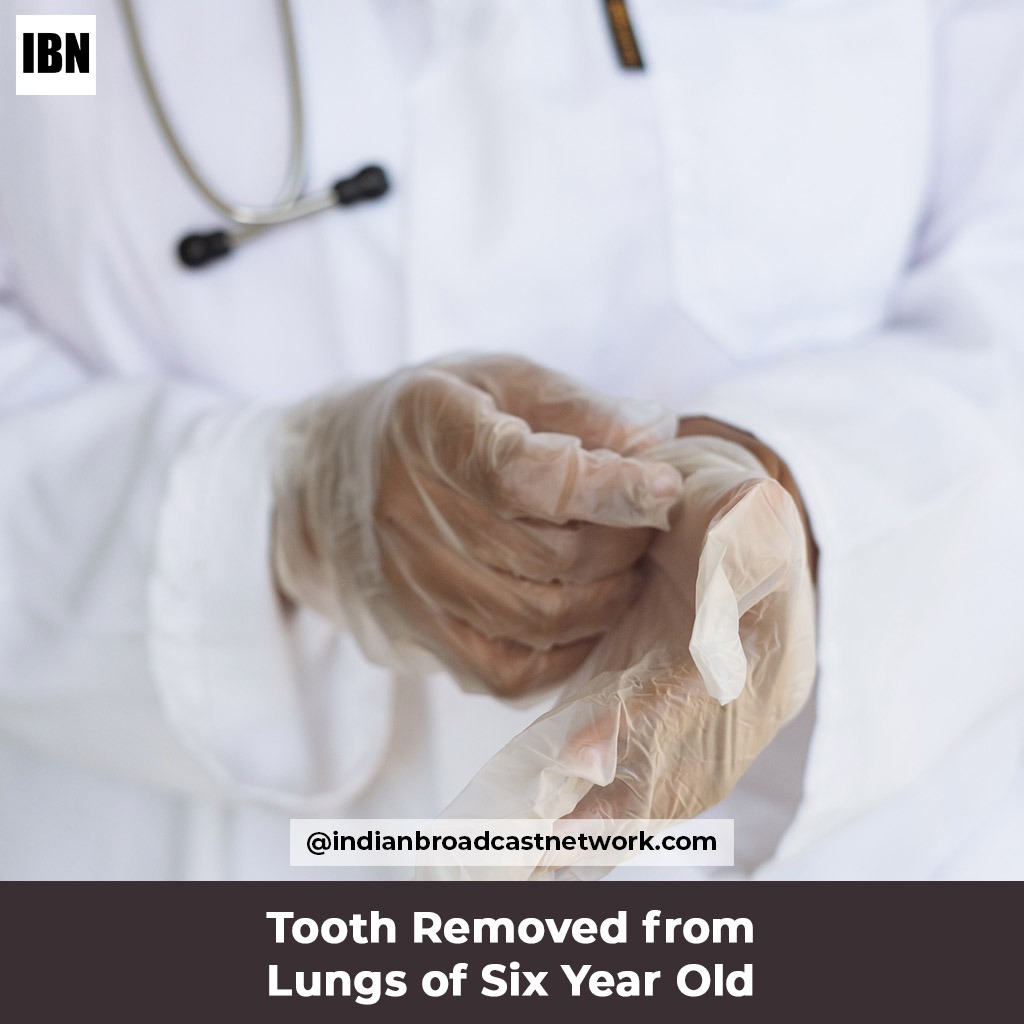 Indian Broadcast Network - Tooth Removed from Lungs of Six Year Old - Wockhardt Hospital, Mira Road, Mumbai